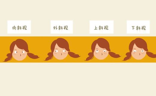 关于儿童斜视，家长最该知道的那些事